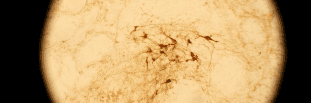 cIceAKOeiWNNDKFZ0ExufpR8Xe0